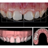 DIGITALE LÄCHELNGESTALTUNG (DIGITAL SMILE DESIGN)